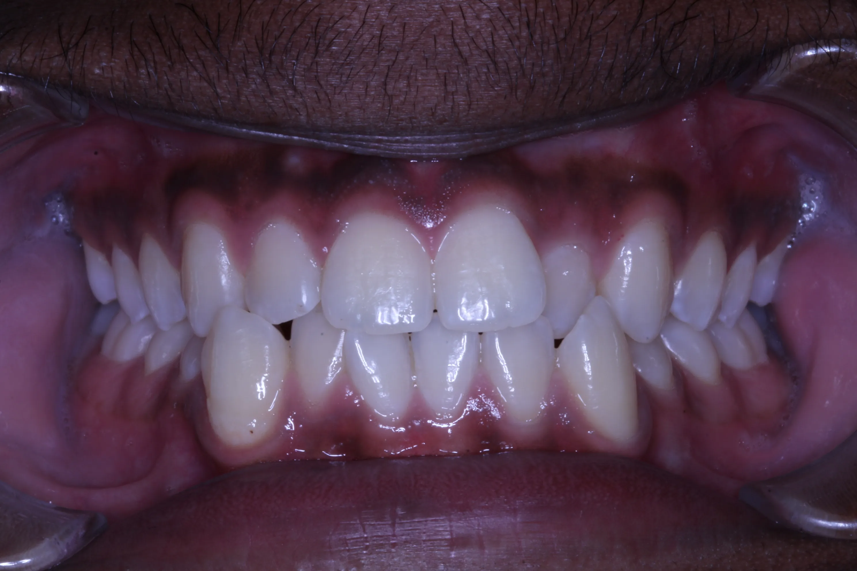 smile-gallery gallery